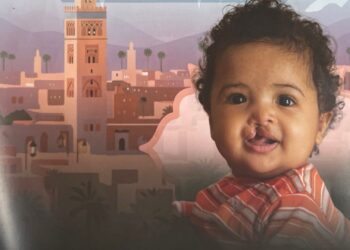 مراكش تحتضن بعثة إنسانية مجانية لإعادة الابتسامة للأطفال المصابين بتشوهات خلقية