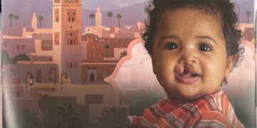 مراكش تحتضن بعثة إنسانية مجانية لإعادة الابتسامة للأطفال المصابين بتشوهات خلقية