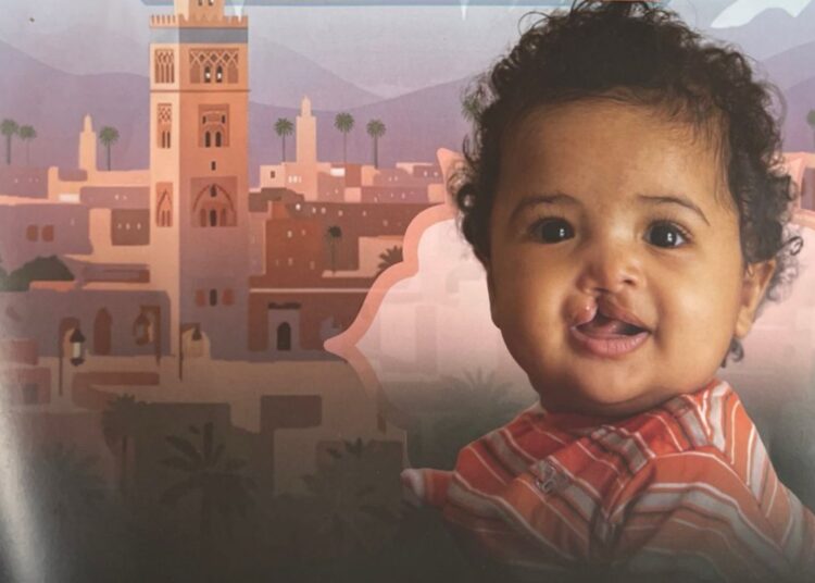 مراكش تحتضن بعثة إنسانية مجانية لإعادة الابتسامة للأطفال المصابين بتشوهات خلقية